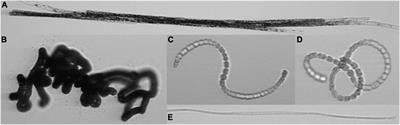 First Application of IFCB High-Frequency Imaging-in-Flow Cytometry to Investigate Bloom-Forming Filamentous Cyanobacteria in the Baltic Sea